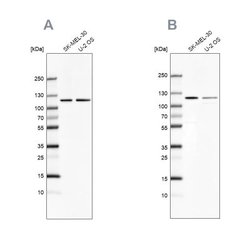 LONP1 Antibody, Novus Biologicals LONP1 Antibody; Unconjugated; 100 &mu;L:Antibodies,